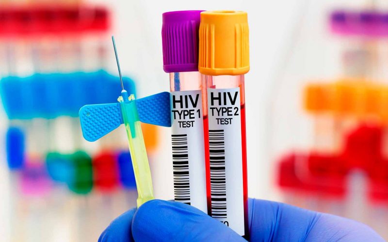 Medicamento demonstra eficácia de 100% para a prevenção do HIV