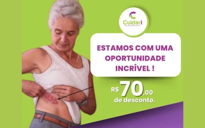 Entendendo o Herpes Zoster e a Importância da Vacinação: Campanha da Cuidari